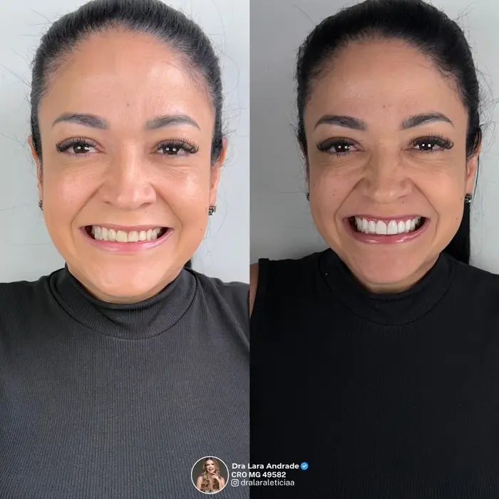 Resultado antes e depois 4