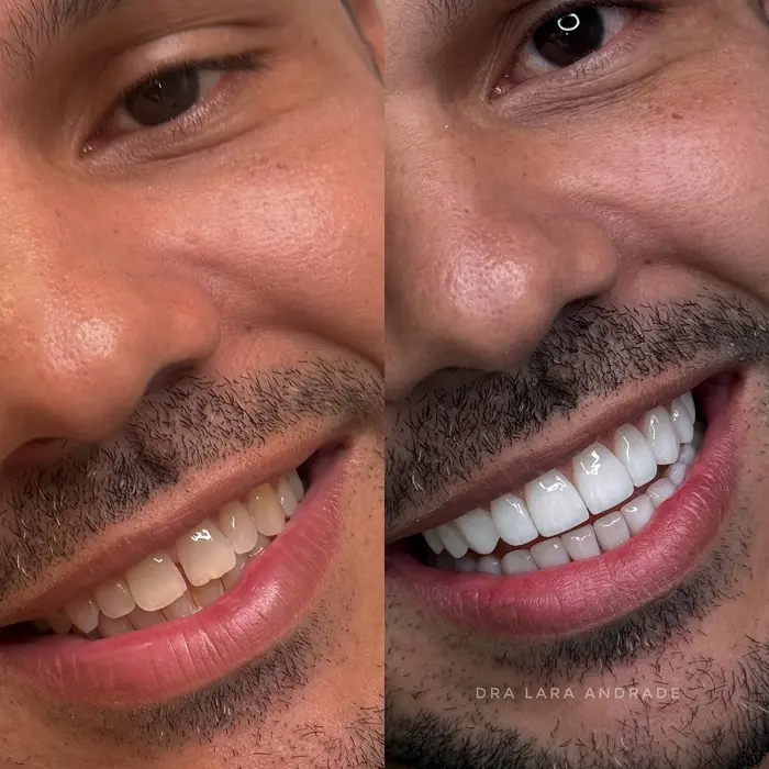Resultado antes e depois 7