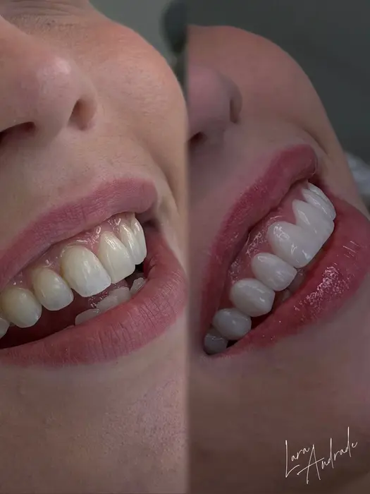 Resultado antes e depois 8